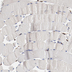 Immunohistochemical staining of human skeletal muscle shows no cytoplasmic positivity in myocytes as expected.