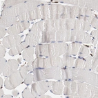 Immunohistochemical staining of human skeletal muscle shows no cytoplasmic positivity in myocytes as expected.