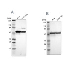 Anti-PDIA3 Antibody