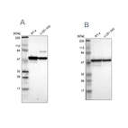Western blot analysis using Anti-PDIA3 antibody HPA002645 (A) shows similar pattern to independent antibody HPA003230 (B).