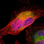 Immunofluorescent staining of human cell line U-2 OS shows localization to endoplasmic reticulum.
