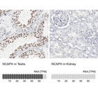 Anti-NCAPH Antibody