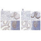 Immunohistochemical staining of human kidney, skin, testis and tonsil using Anti-NCAPH antibody HPA002647 (A) shows similar protein distribution across tissues to independent antibody HPA003008 (B).
