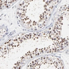Immunohistochemical staining of human testis shows nuclear positivity in cells in seminiferous ducts.