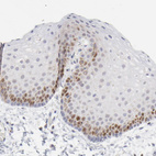 Immunohistochemical staining of human skin shows nuclear positivity in epidermal cells.