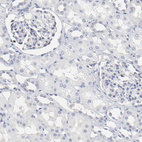 Anti-NCAPH Antibody