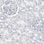 Immunohistochemical staining of human kidney shows no positivity as expected.