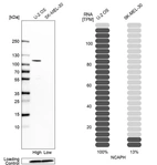 Western blot analysis in human cell lines U2OS and SK-MEL-30 using Anti-NCAPH antibody. Corresponding NCAPH RNA-seq data are presented for the same cell lines. Loading control: Anti-COX4I1.