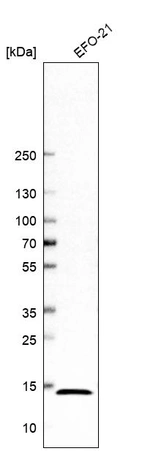 Western blot analysis in human cell line EFO-21.