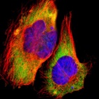 Immunofluorescent staining of human cell line U-251 MG shows localization to cytosol & endoplasmic reticulum.