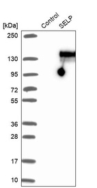 Western blot analysis in control (vector only transfected HEK293T lysate) and SELP over-expression lysate (Co-expressed with a C-terminal myc-DDK tag (~3.1 kDa) in mammalian HEK293T cells, LY418960).