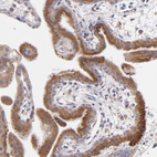 Anti-IFIH1 Antibody