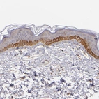 Immunohistochemical staining of human skin shows moderate cytoplasmic positivity in squamous epithelial cells.