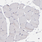 Anti-IFIH1 Antibody