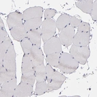Immunohistochemical staining of human skeletal muscle shows no positivity in myocytes as expected.