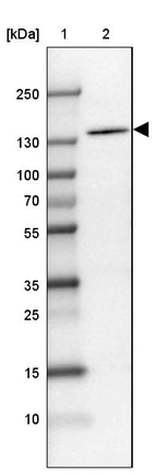Lane 1: Marker [kDa] 250, 130, 100, 70, 55, 35, 25, 15, 10_br/_Lane 2: Human cell line SK-MEL-30
