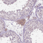 Anti-CPM Antibody