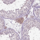 Immunohistochemical staining of human testis shows moderate membranous positivity in Leydig cells.