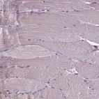 Immunohistochemical staining of human skeletal muscle shows no positivity in myocytes as expected.