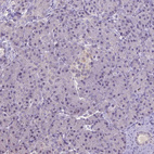 Immunohistochemical staining of human pancreas shows no positivity in exocrine glandular cells as expected.