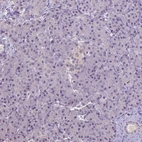 Immunohistochemical staining of human pancreas shows no positivity in exocrine glandular cells as expected.