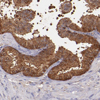 Anti-WASHC1 Antibody