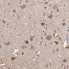 Anti-WASHC1 Antibody