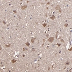 Immunohistochemical staining of human cerebral cortex shows moderate cytoplasmic positivity in neurons.