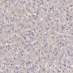 Anti-WASHC1 Antibody