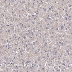 Immunohistochemical staining of human liver shows no positivity in hepatocytes as expected.