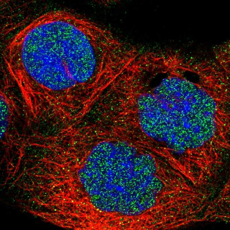 Anti-FBXO11 Antibody