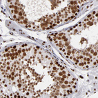 Immunohistochemical staining of human testis shows moderate to strong nuclear positivity in cells in seminiferous ducts.