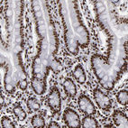 Anti-MRE11 Antibody