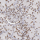 Anti-MRE11 Antibody
