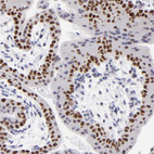 Anti-DNMT1 Antibody