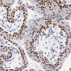 Immunohistochemical staining of human placenta shows strong nuclear positivity in cytotrophoblast.