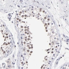 Immunohistochemical staining of human testis shows moderate nuclear positivity in cells in seminiferous ducts.