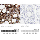 Anti-LCN2 Antibody