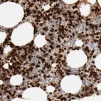 Immunohistochemical staining of human bone marrow shows strong cytoplasmic positivity in hematopoietic cells.
