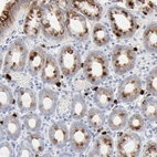 Immunohistochemical staining of human stomach shows strong cytoplasmic positivity in glandular cells.