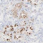 Immunohistochemical staining of human kidney shows strong granular cytoplasmic positivity in subset of cells in tubules.