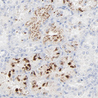 Anti-LCN2 Antibody