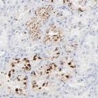Immunohistochemical staining of human kidney shows strong granular cytoplasmic positivity in subset of cells in tubules.