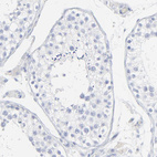 Anti-LCN2 Antibody