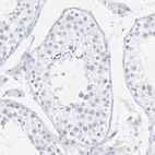 Immunohistochemical staining of human testis shows no positivity in cells in seminiferous ducts as expected.