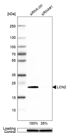 Western blot analysis in Capan-2 cells transfected with control siRNA, target specific siRNA probe #1, using Anti-LCN2 antibody. Remaining relative intensity is presented. Loading control: Anti-GAPDH.