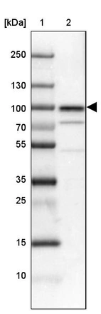 Lane 1: Marker [kDa] 250, 130, 100, 70, 55, 35, 25, 15, 10_br/_Lane 2: Human cell line NTERA-2