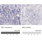 Anti-IRF4 Antibody