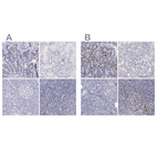 Immunohistochemical staining of human duodenum, kidney, pancreas and tonsil using Anti-IRF4 antibody HPA002698 (A) shows similar protein distribution across tissues to independent antibody HPA002038 (B).