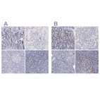 Anti-IRF4 Antibody